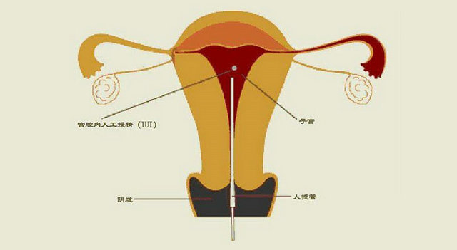 89.jpg