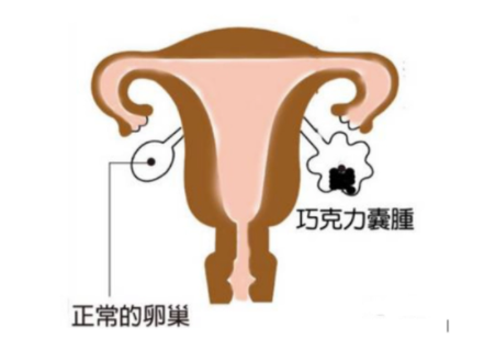 Թܳɹкô